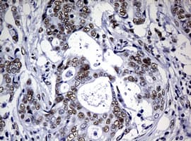 NBN / Nibrin Antibody (aa183-460, clone OTI2F5, Carrier-free)