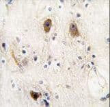 Polyclonal Rabbit anti-Human ROR2 Antibody (IHC, WB)