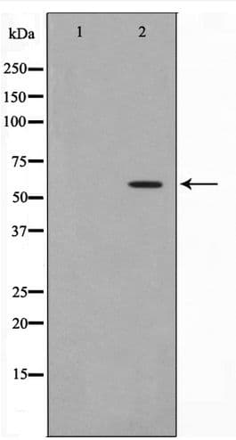 HBP1 Antibody (phospho-Ser402)