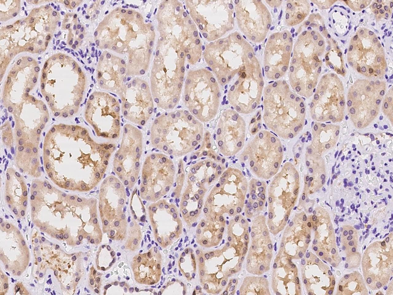 TMEM168 Antibody