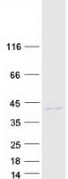 Human RNLS / Renalase Protein (Recombinant Myc-DDK (Flag))