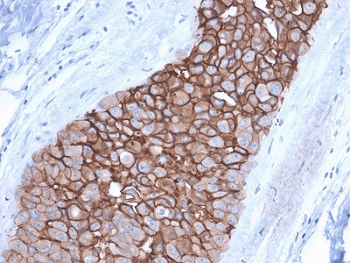ERBB2 / HER2 Antibody (clone ERBB2/3092, Ready-to-Use)