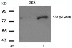 TP73 / p73 Antibody