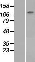 SLC12A6 / KCC3 Protein (Over-Expression Lysate Myc-DDK (Flag))