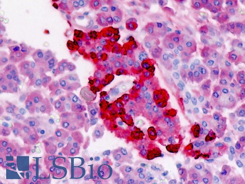 IHC-plus™ TTR / Transthyretin Antibody