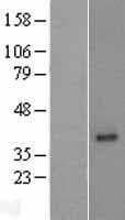 MOGAT2 Protein (Over-Expression Lysate Myc-DDK (Flag))