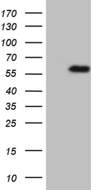 Monoclonal Mouse anti-Human TNFRSF19 / TROY Antibody (clone OTI1B7, aa30-170, WB)
