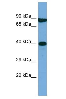 Polyclonal Rabbit anti-Human M1AP Antibody (aa160-209, WB)
