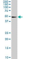 Monoclonal Mouse anti-Human CDK8 Antibody (clone 6H5, WB)