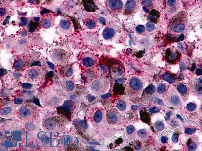 PathPlus™ Polyclonal Rabbit anti-Human RXFP1/ LGR7 Antibody (N-Terminus, IHC)