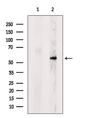 Polyclonal Rabbit anti-Human POMGNT1 Antibody (IF, WB)