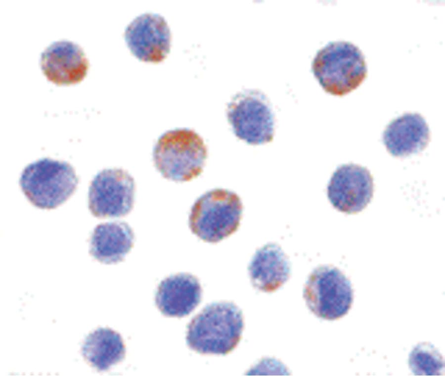 IHC-plus™ DDX3 / DDX3X Antibody