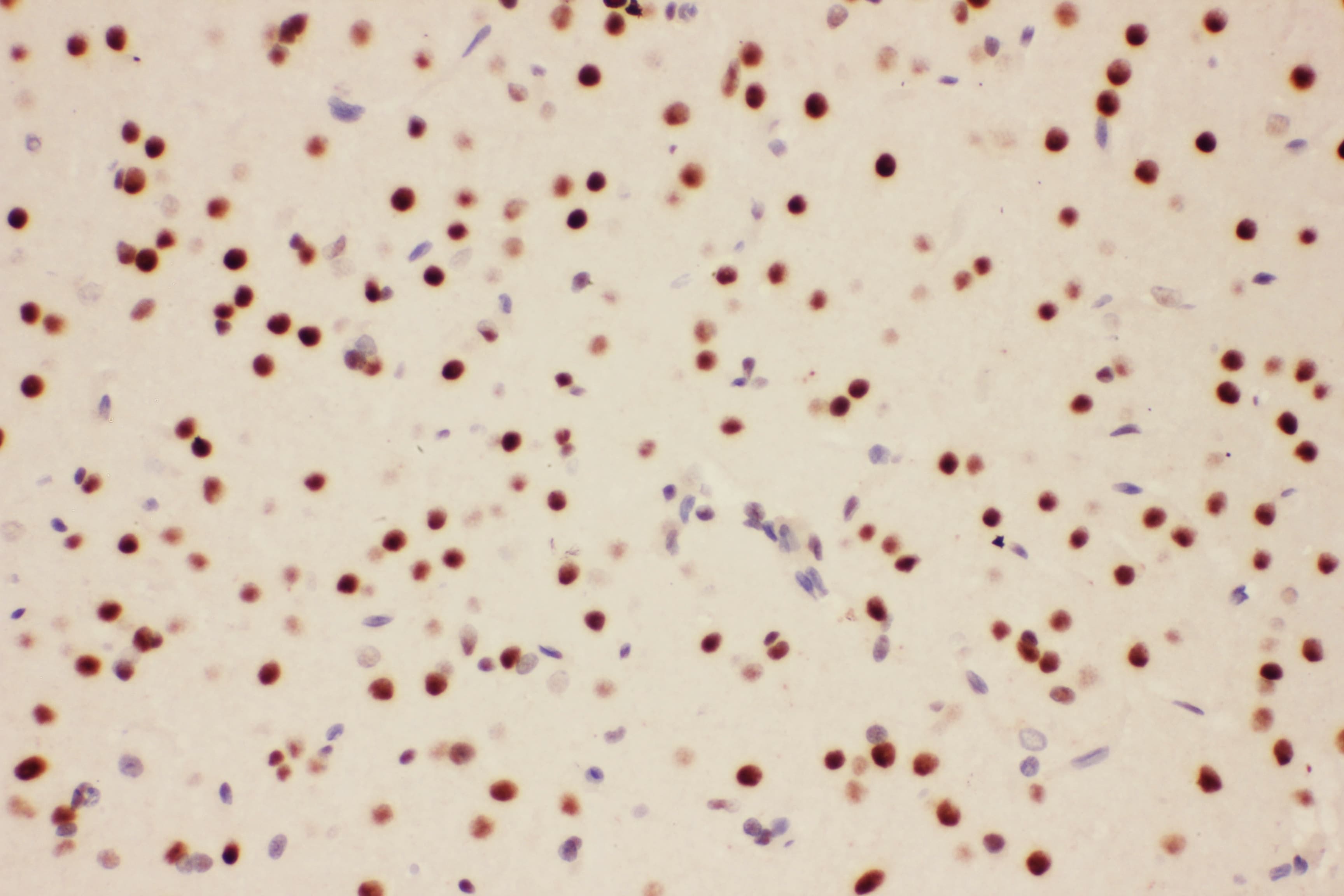 PIAS1 Antibody (aa636-651)