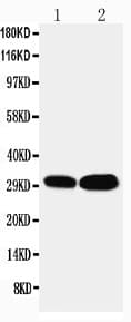 Polyclonal Rabbit anti-Human LASP1 Antibody (aa152-168, IHC, WB)