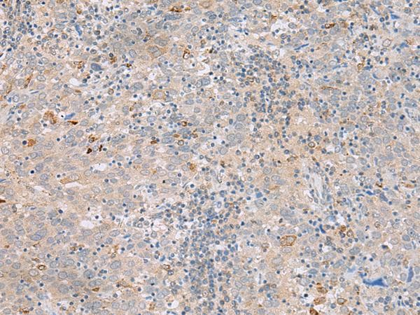 SAXO2 / FAM154B Antibody