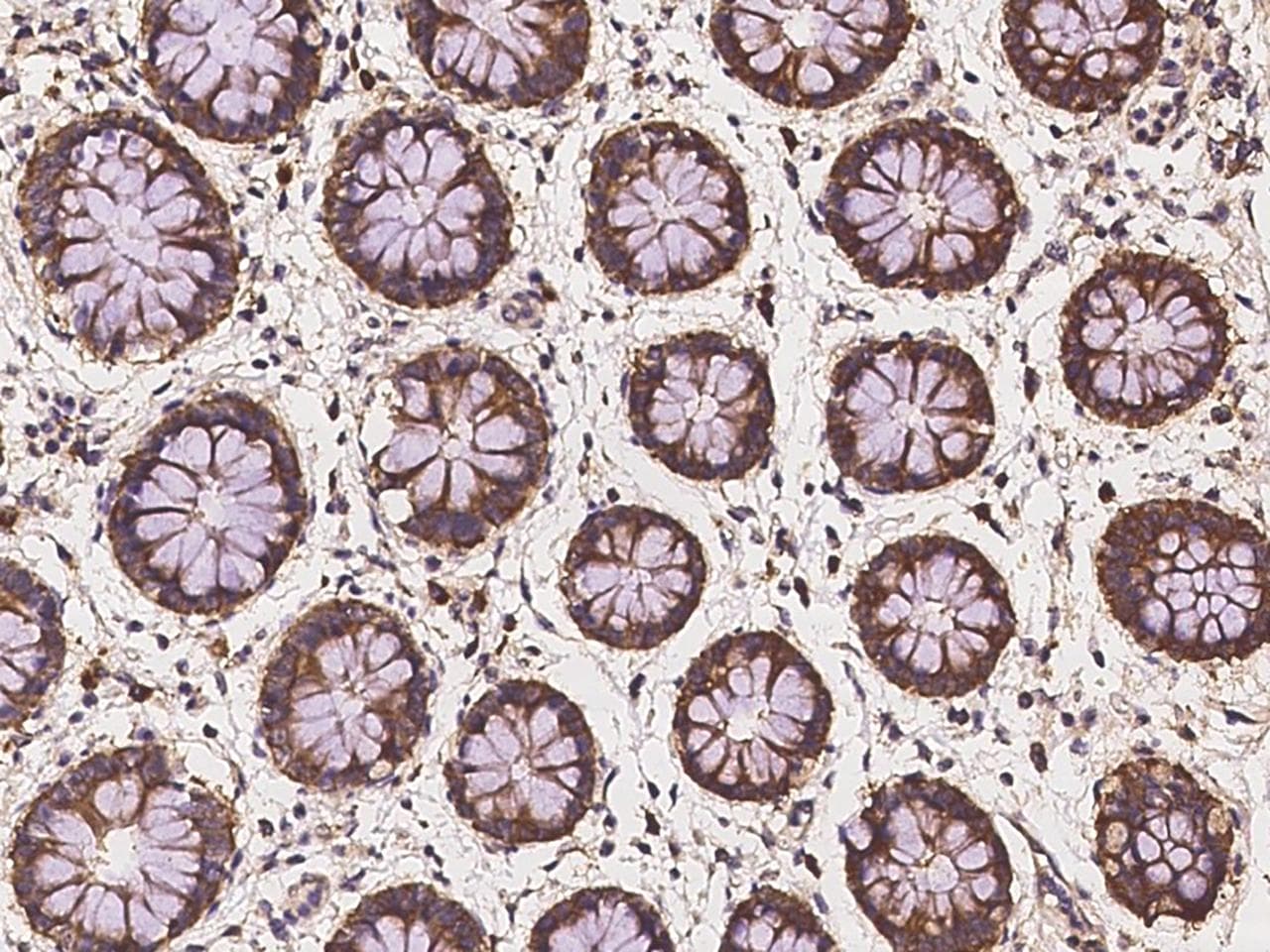NAK / TBK1 Antibody