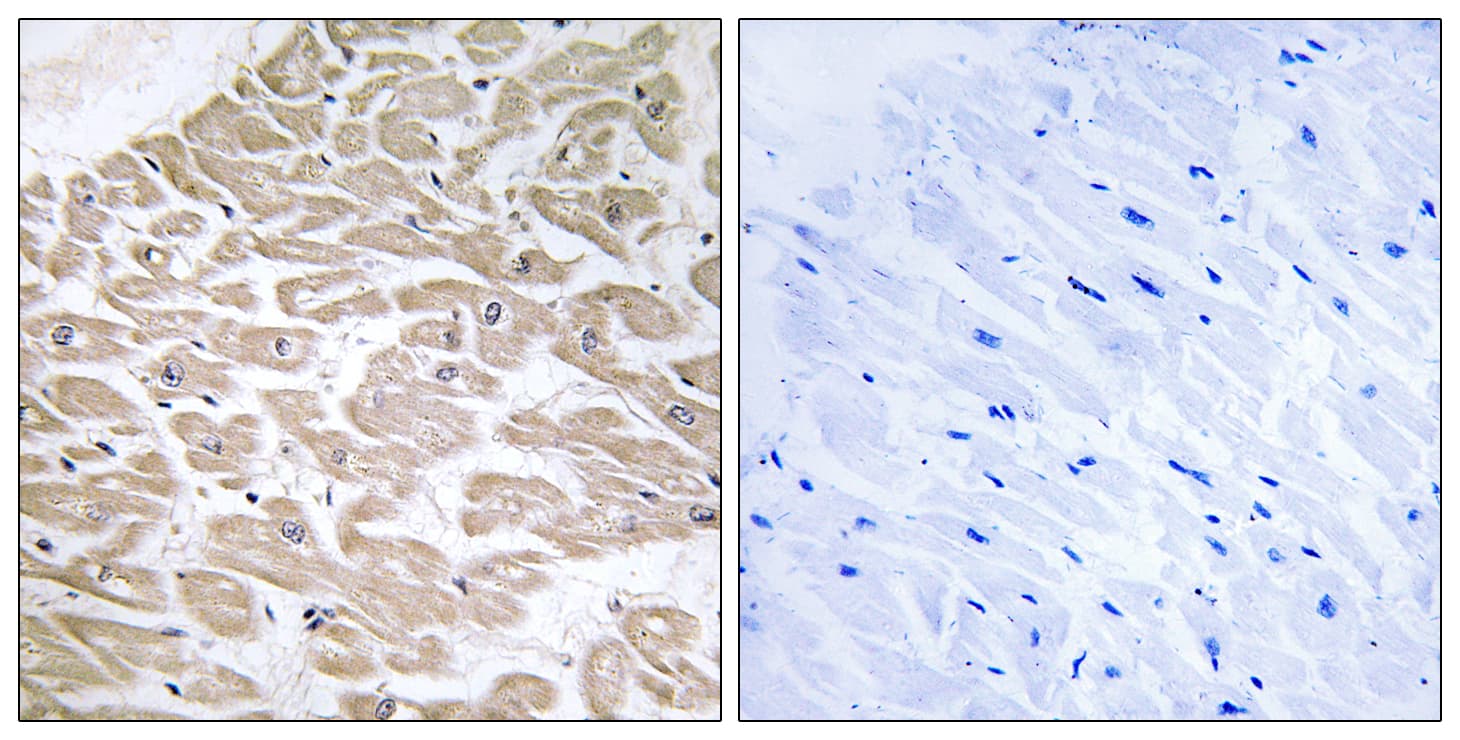 RRAD Antibody (aa41-90)