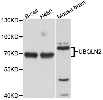 Ubiquilin 2 / UBQLN2 Antibody