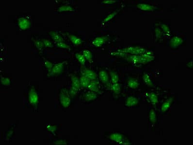 TFE3 Antibody