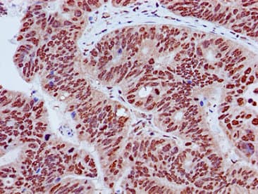 Polyclonal Rabbit anti-Human HIST1H3A Antibody (IHC, IF, WB)