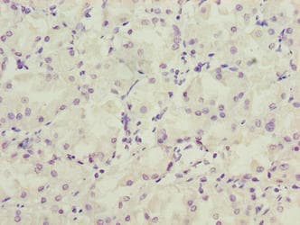 LRRC20 Antibody