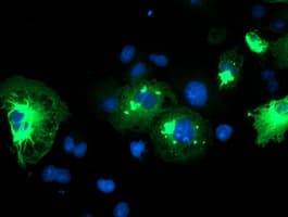 SPRING / TRIM9 Antibody (aa284-669, clone OTI2B5)