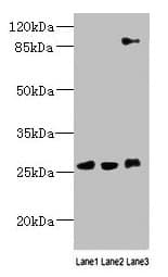 Polyclonal Rabbit anti-Human DNAJC30 Antibody (IHC)