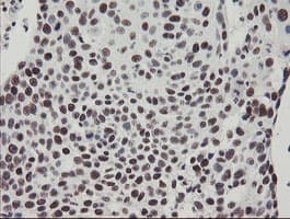 Monoclonal Mouse anti-Human TPRKB Antibody (clone OTI1E9, IHC, WB)