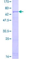 Human ACADSB Protein (Recombinant GST)