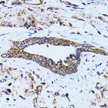 Polyclonal Rabbit anti-Human GCN2 Antibody (IHC, IF, WB)
