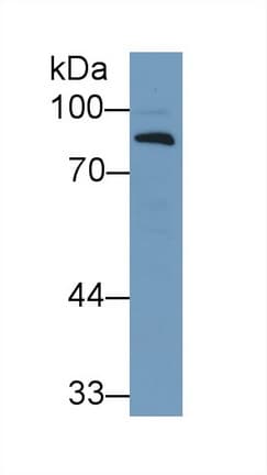 CFB / Complement Factor B Antibody (aa270-388)