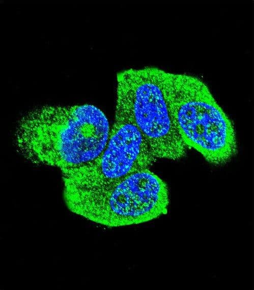 HRAS / H-Ras Antibody (aa146-176)