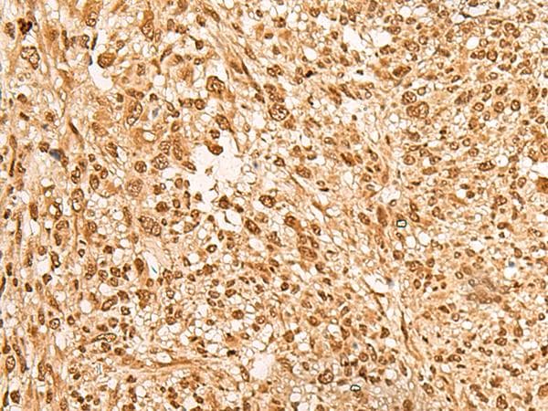HN1L Antibody