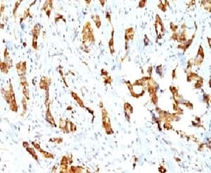 HSPB1 / HSP27 Antibody (clone SPM252)