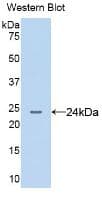 AGR2 Antibody (aa21-175, clone C1)