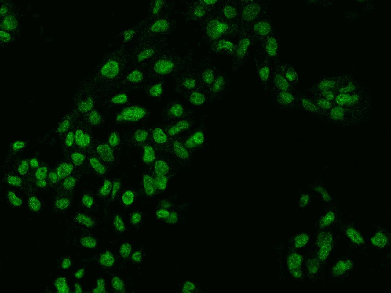 ZKSCAN2 Antibody