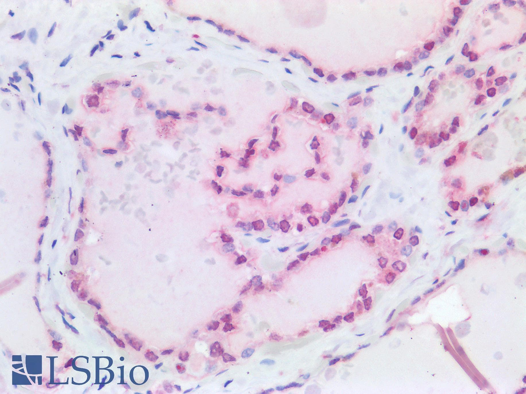 PathPlus™ p84 / THOC1 Antibody (aa15-374, clone 5E10)