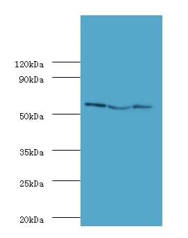 USP14 Antibody