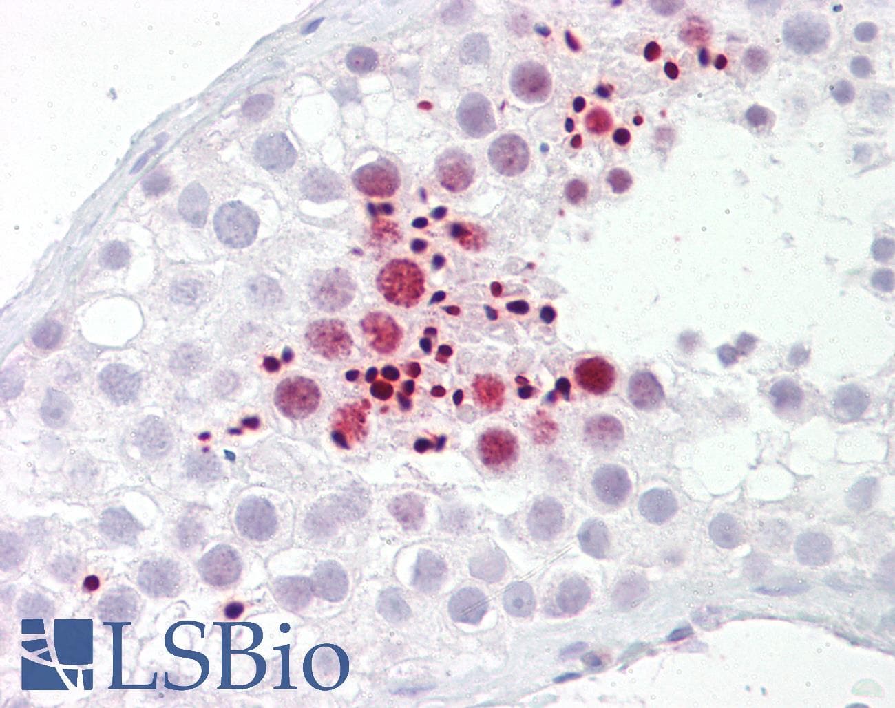 IHC-plus™ SIK1 / MSK Antibody