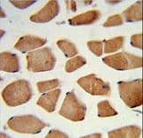 RD / PHYH Antibody (aa59-87)