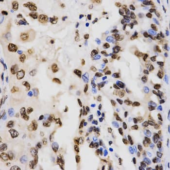 Histone H3 Antibody (Tri-Methyl-Lys9)