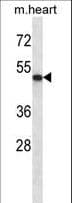ABI2B / ABI2 Antibody (aa1-30)