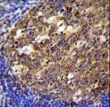 TWF2 / PTK9L Antibody (aa28-57)