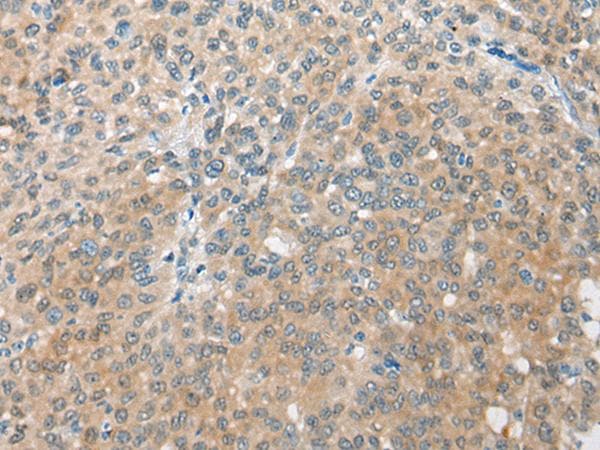 CBR3 Antibody