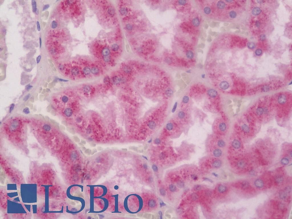 PathPlus™ RAB5A / RAB5 Antibody (C-Terminus)