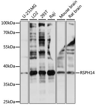 RSPH14 / RTDR1 Antibody
