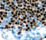 Recombinant Monoclonal Rabbit anti-Human PAX5 Antibody (clone RBT-PAX5, IHC)