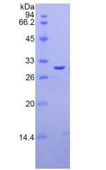 Rat LGALS3 / Galectin 3 Protein (Recombinant His)