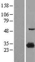 Human 15-PGDH / HPGD Protein (Over-Expression Lysate Myc-DDK (Flag))