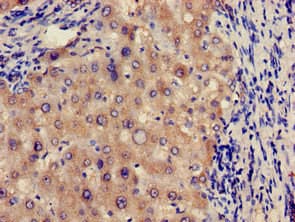 Polyclonal Rabbit anti-Human Alpha Fucosidase / FUCA1 Antibody (IHC)